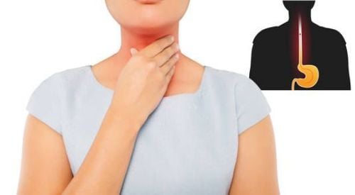 Trào ngược axit dạ dày thực quản cũng là một dạng bệnh tiêu hóa gây ra cảm giác nóng rát ở ngực và cổ họng