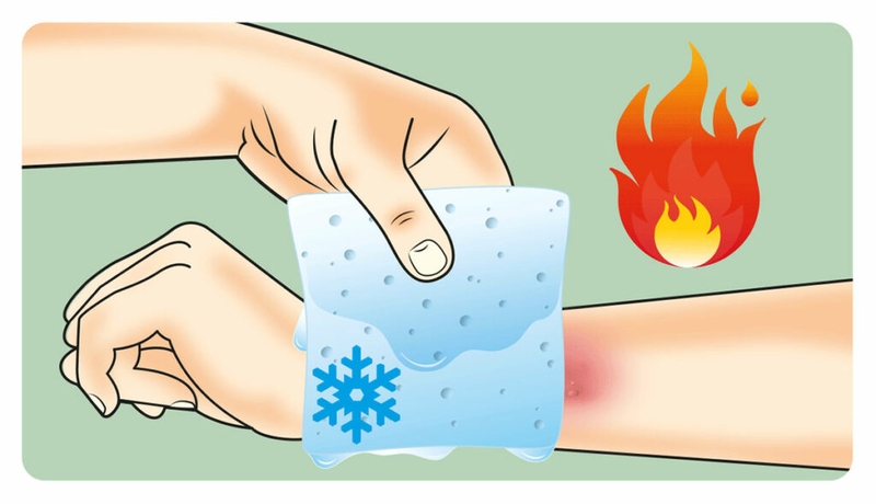 Bị bỏng bôi gì​ và không nên bôi gì để vết thương nhanh lành? 3