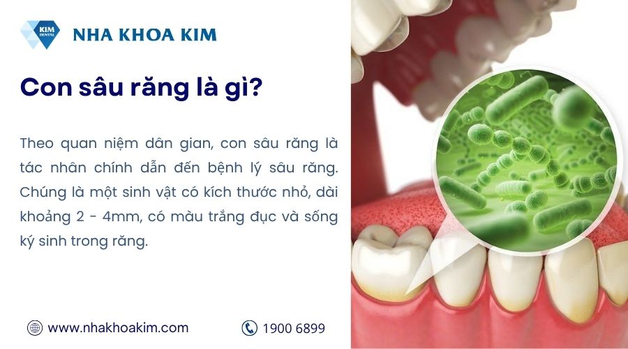 Con sâu răng là gì? Có thật không? Cách để bắt con sâu răng