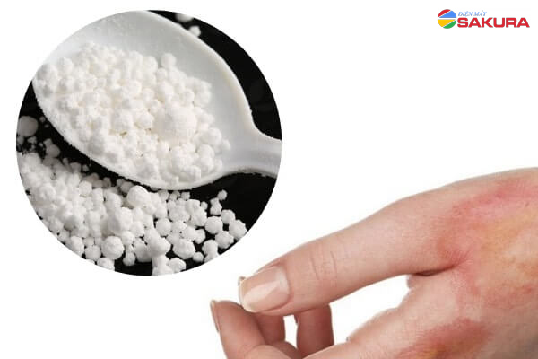 Clorua vôi có gây độc không? Lưu ý khi sử dụng Clorua vôi