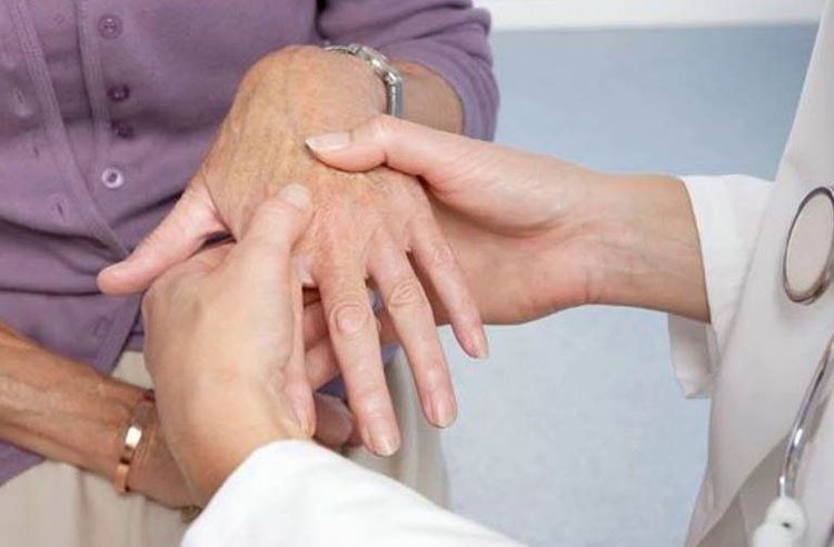 Người mắc bệnh lupus ban đỏ có thể bị viêm khớp