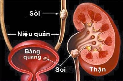 Đi tiểu nhiều lần trong ngày cảnh báo bệnh gì?