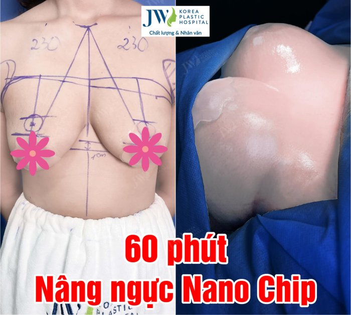 60-phut-nang-nguc-nano-chip