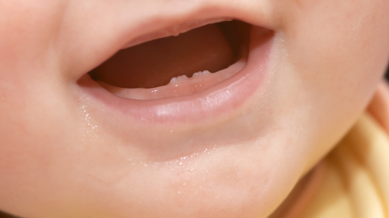 Hình ảnh trẻ đi tướt mọc răng và cách chăm sóc cha mẹ nên biết rõ2