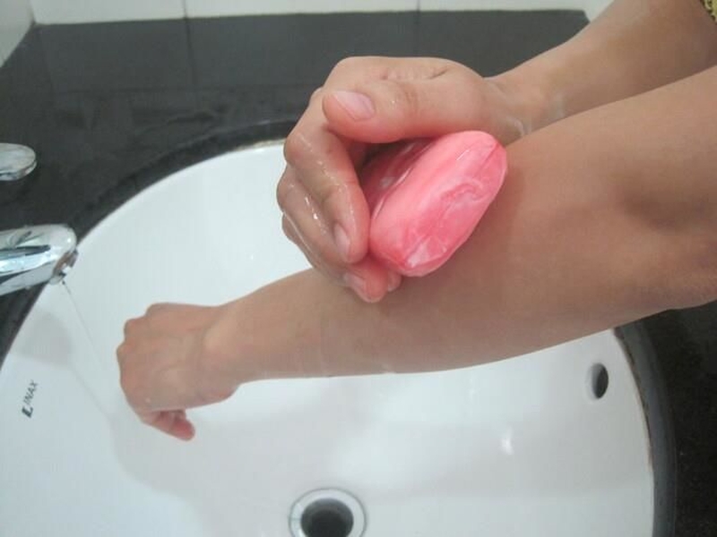 Cách trị kiến cắn đơn giản và an toàn tại nhà