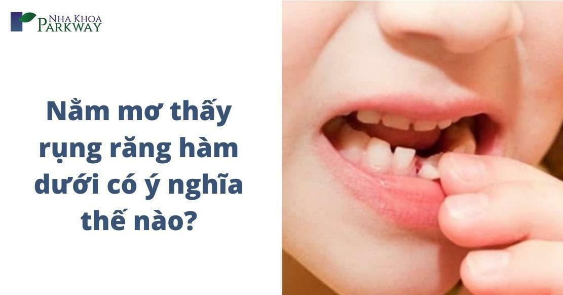 Nằm mơ thấy rụng răng hàm dưới có ý nghĩa thế nào?