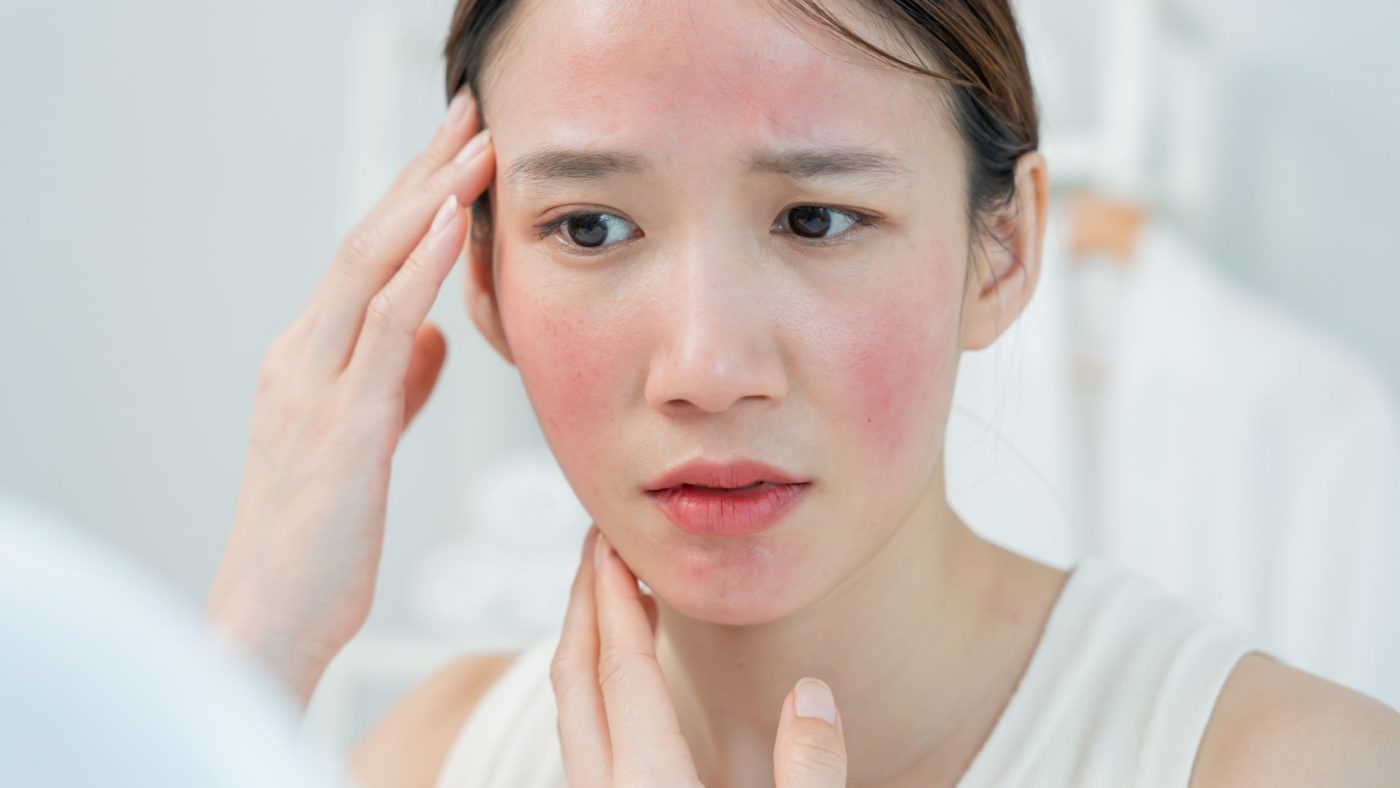 Những người không nên uống trà hoa hồng: Lưu ý để tránh tác dụng phụ