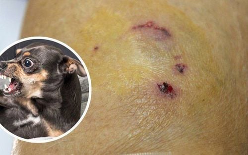 Không chỉ lây qua vết cắn, bệnh dại còn lây qua nước bọt của động vật