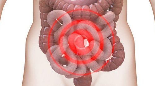 Đau bụng dưới âm ỉ ở nữ là bệnh gì?