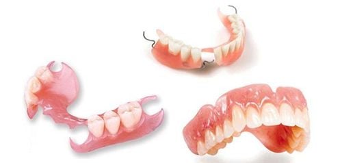 Phục hình tháo lắp