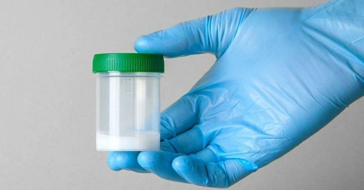 Cách duy nhất để có thể đánh giá tinh dịch một cách chính xác là phân tích mẫu tinh dịch