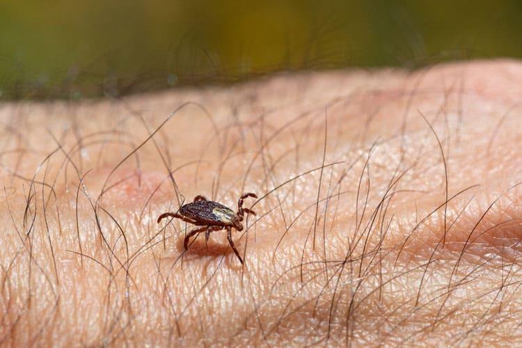 Bị ve chó cắn phải làm sao?