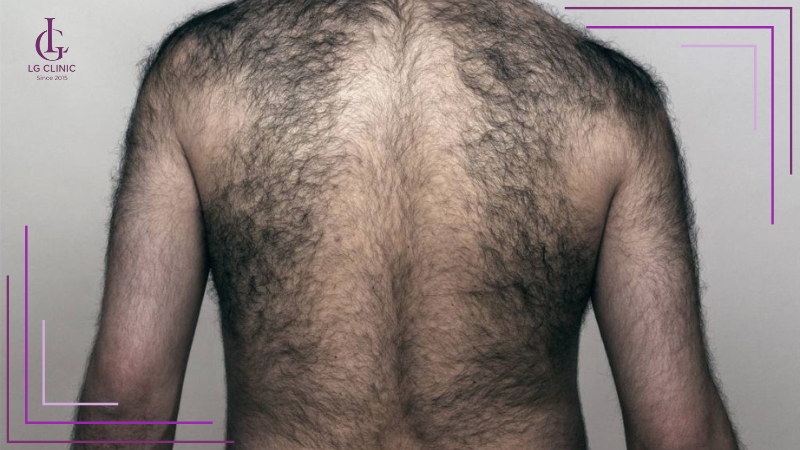 Vòng xoáy lông ở lưng đàn ông