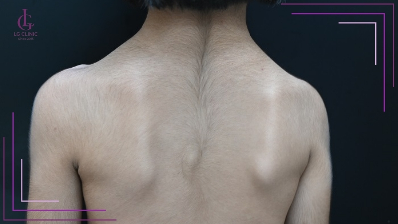 Xem tướng xoáy lông ở lưng luận giải vận mệnh và tính cách