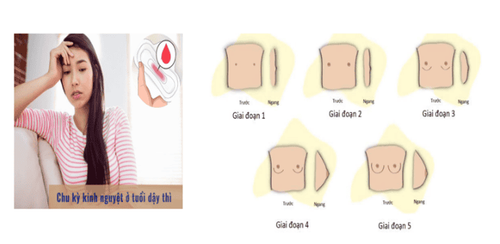 Hình 3. Xuất hiện kinh nguyệt và sự phát triển ngực trong tuổi dậy thì ở cả bé gái