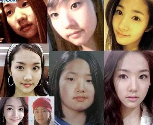 10+gái xinh vướng tin thay đổi ngoại hình nhờ phẫu thuật thẩm mỹ