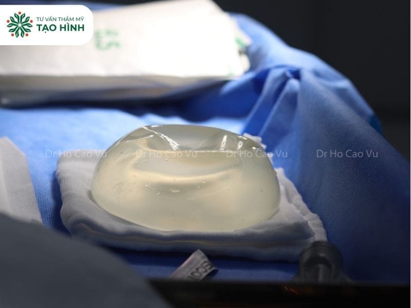 Nâng ngực size to ảnh hưởng tới vòng 1 ra sao? Giải đáp từ bác sĩ