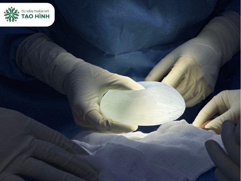 Nâng ngực size to ảnh hưởng tới vòng 1 ra sao? Giải đáp từ bác sĩ