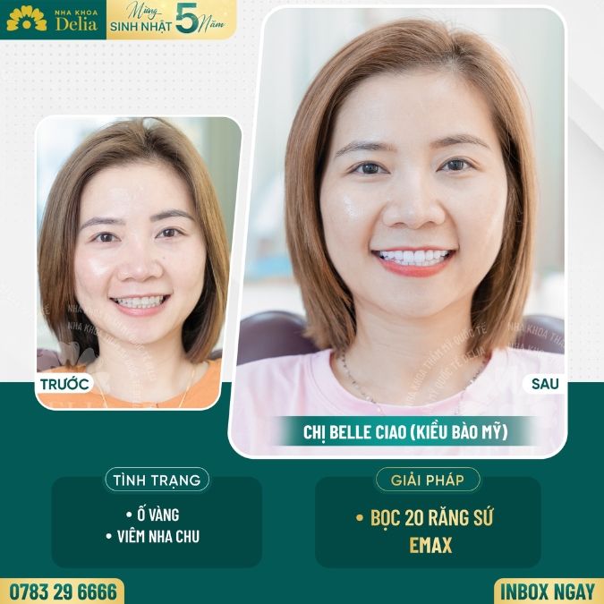 Cách đơn giản nhất để có một bức ảnh selfie đẹp cho nam và nữ 