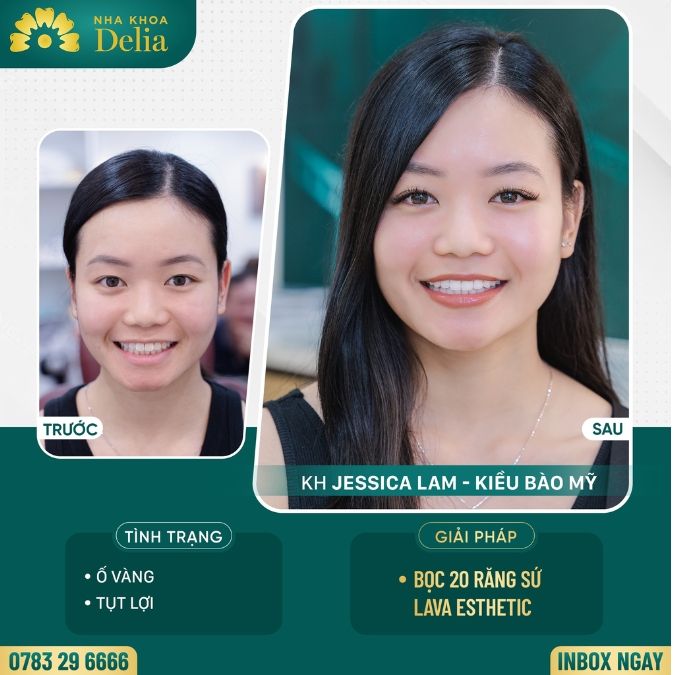 Cách đơn giản nhất để có một bức ảnh selfie đẹp cho nam và nữ 