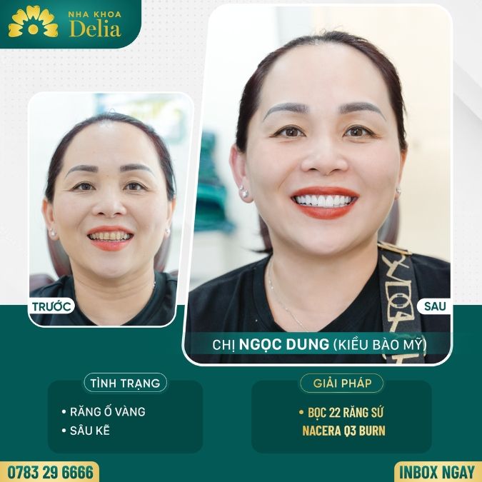 Cách đơn giản nhất để có một bức ảnh selfie đẹp cho nam và nữ 