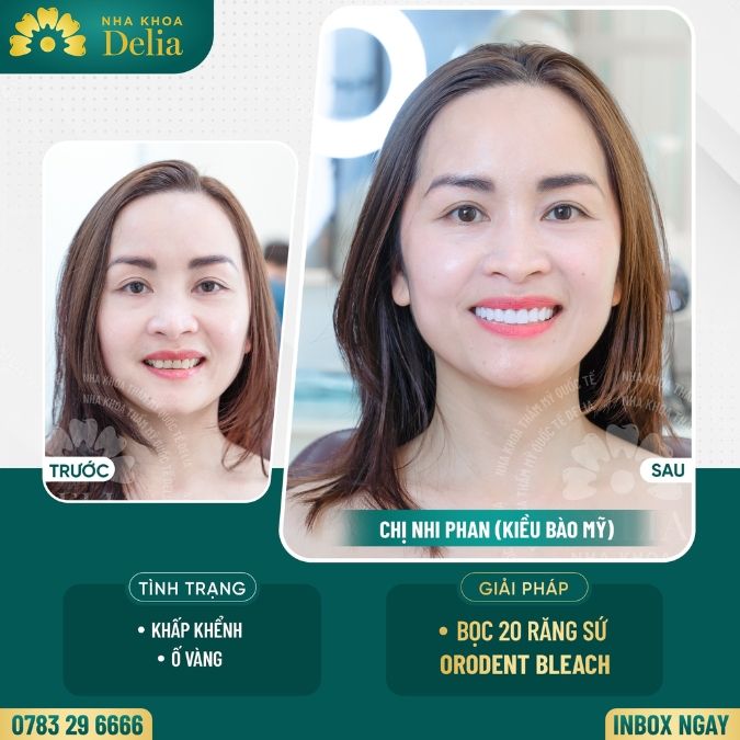 Cách đơn giản nhất để có một bức ảnh selfie đẹp cho nam và nữ 