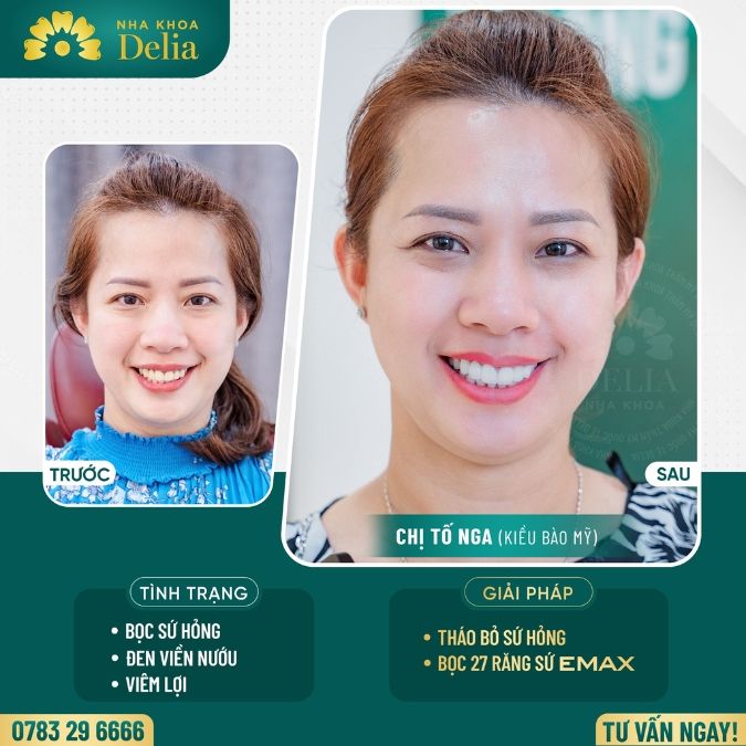 Cách đơn giản nhất để có một bức ảnh selfie đẹp cho nam và nữ 