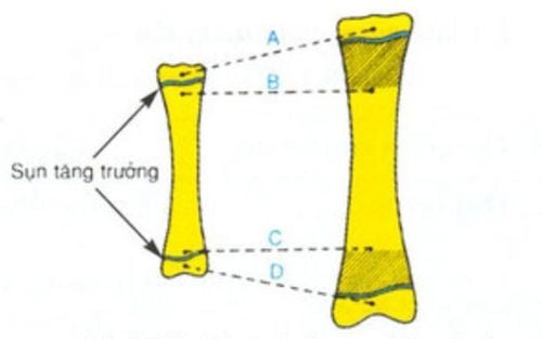 Dấu hiệu xương dài ra khi xuất hiện hình ảnh sụn tăng trưởng