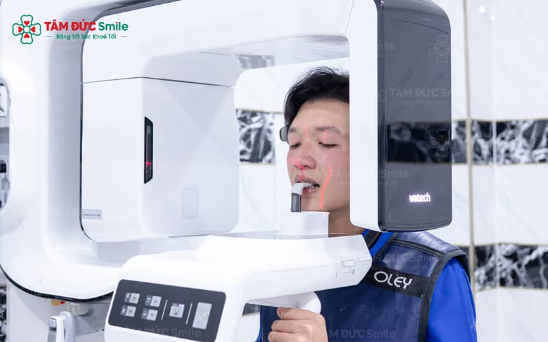 rang-su-zirconia-co-may-loai-2