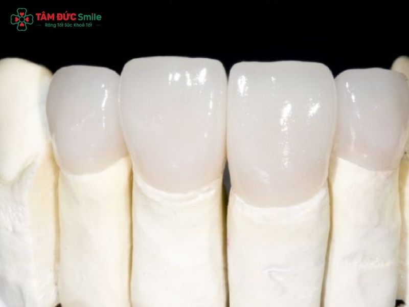 Răng sứ Zirconia có mấy loại? So sánh, giá và ưu điểm từng loại