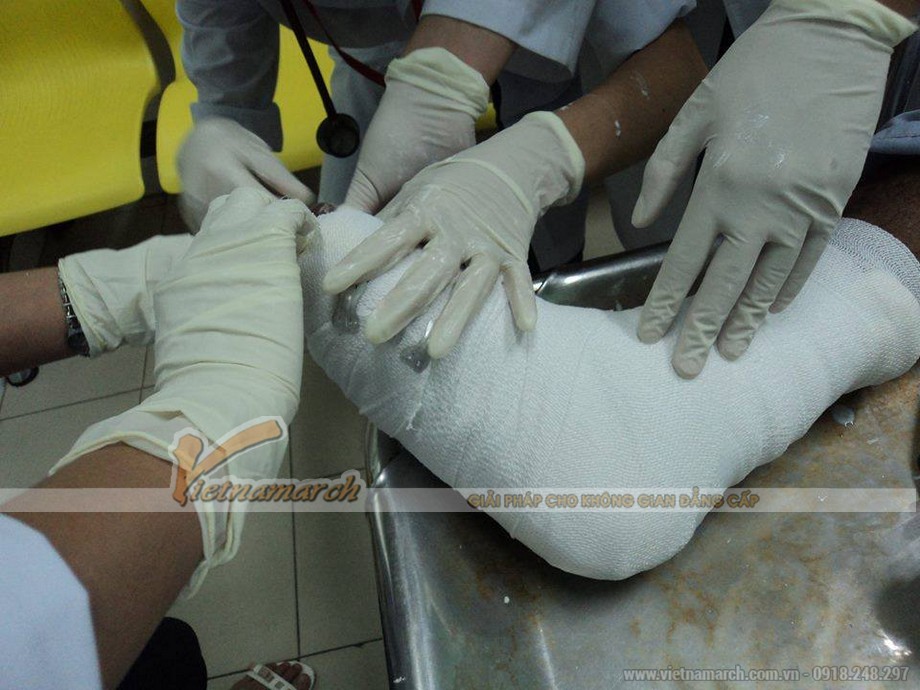 Thạch cao là gì? Công thức hóa học của thạch cao > Thạch cao là gì? Công thức hóa học của thạch cao