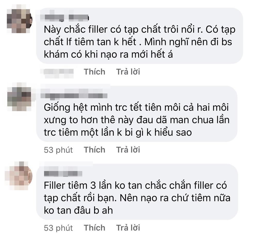 Cư dân mạng bàn tán xôn xao. Người khăng khăng cho rằng, filler này có tạp chất nên tiêm tan không nổi. Trường hợp này bắt buộc phải nạo ra chứ tiêm sẽ không được.