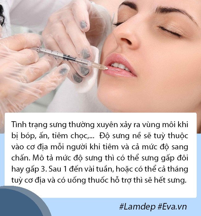 Tâm linh không dám đi cắt môi, gái xinh mạnh dạn tiêm filler nhận ngay đôi môi thảm họa - 6