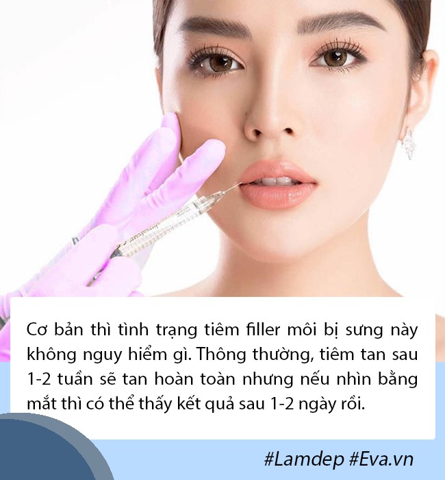 Tâm linh không dám đi cắt môi, gái xinh mạnh dạn tiêm filler nhận ngay đôi môi thảm họa - 7