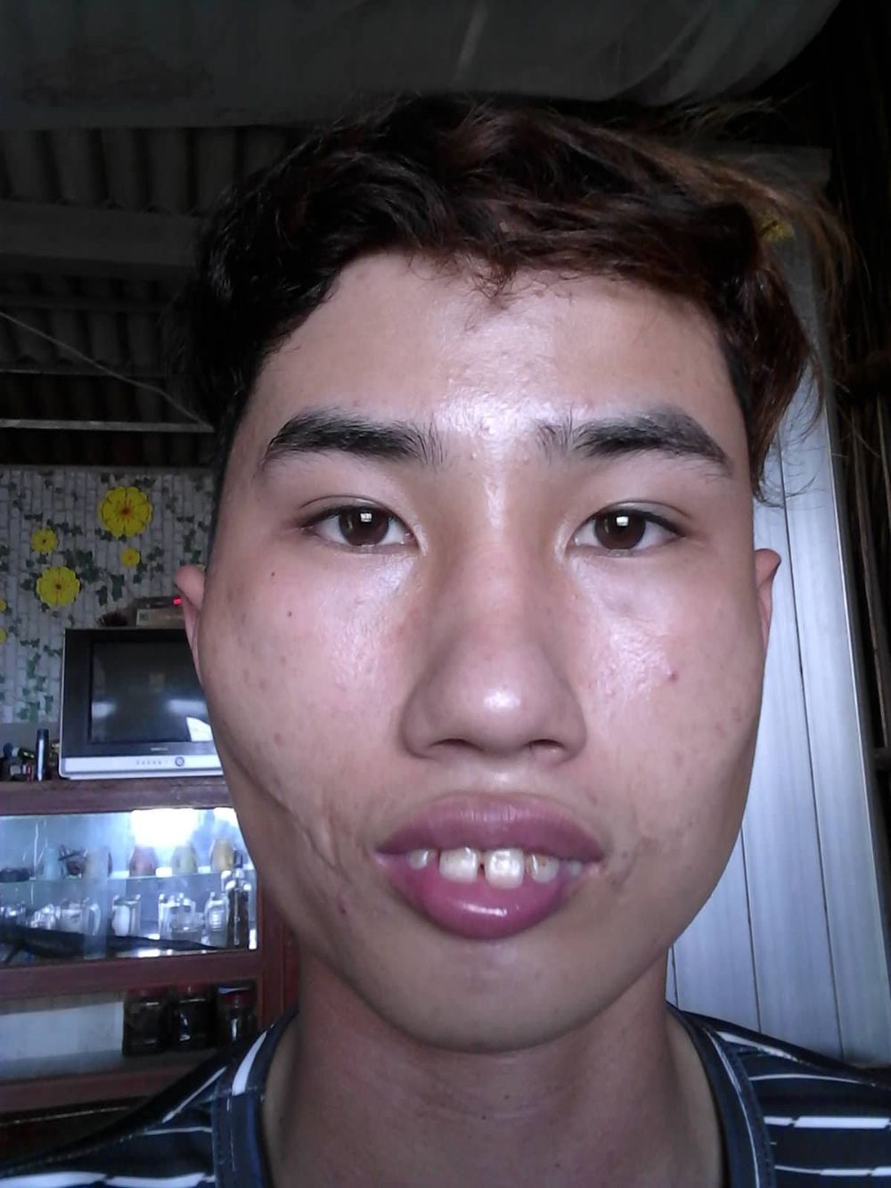 Chụp một lần, dọa cả năm