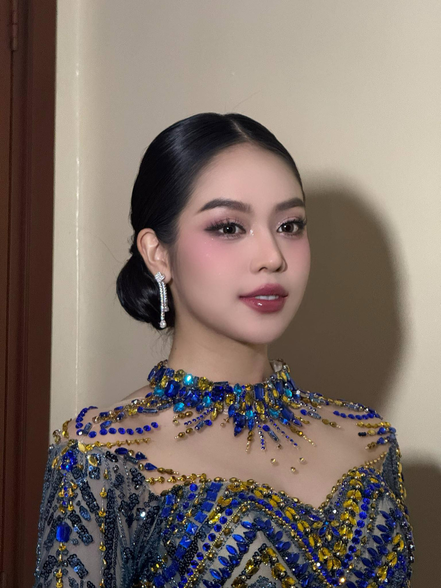 Hoa hậu Thanh Thủy phải nhập viện, truyền nước sau đêm chung kết Puteri Indonesia 2025.