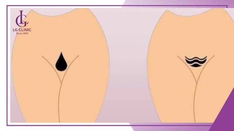 Người mệnh Mộc hợp với dáng bikini giọt nước, lượn sóng