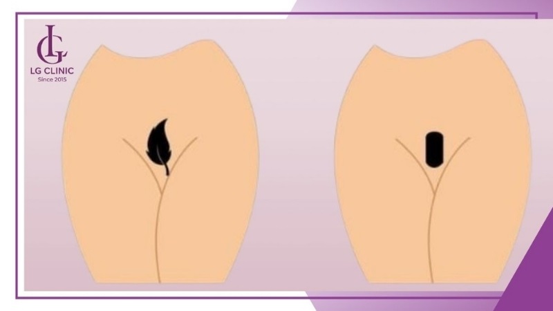 Người mệnh Thủy hợp với dáng bikini hình lá cây, hoa cỏ