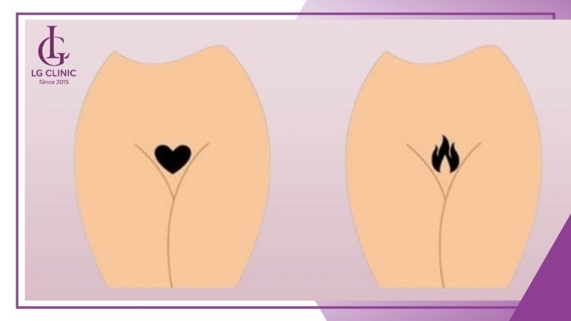 Người mệnh Mộc hợp với dáng bikini hình tam giác, ngọn lửa