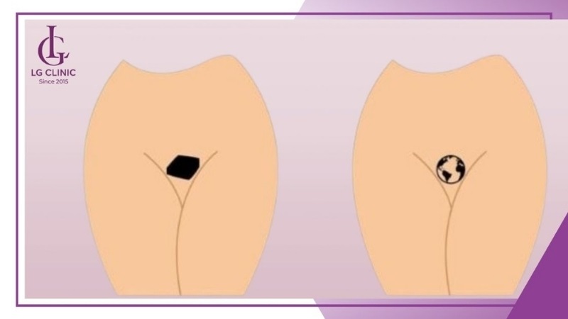 Người mệnh Mộc hợp với dáng bikini hình khối chữ nhật, hình chóp kim tự tháp