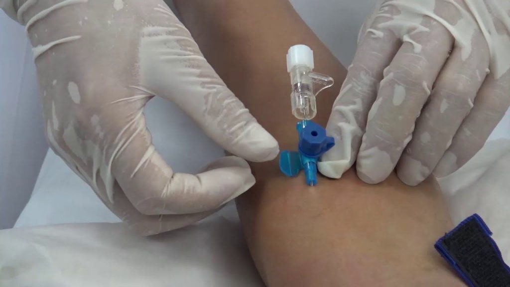 Bác sĩ đang đưa ống dẫn nước biển vào tĩnh mạch