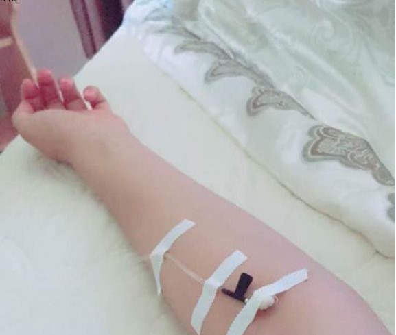 Hình ảnh thực tế vô nước biển trên tay nữ