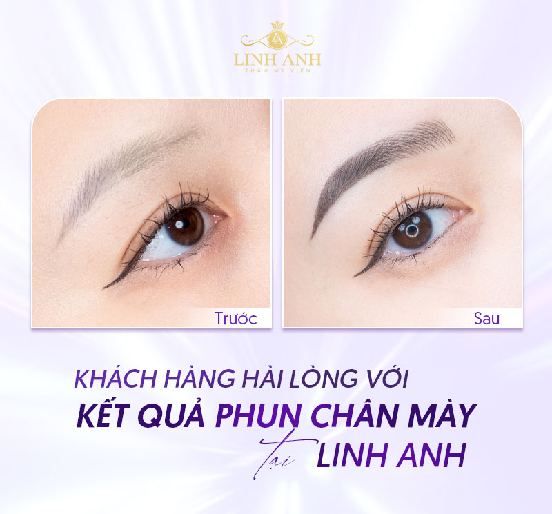 bảng giá phun mày tại TMV Linh Anh