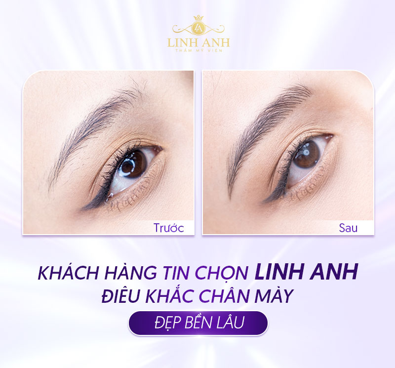 bảng giá điêu khắc mày tại TMV Linh Anh