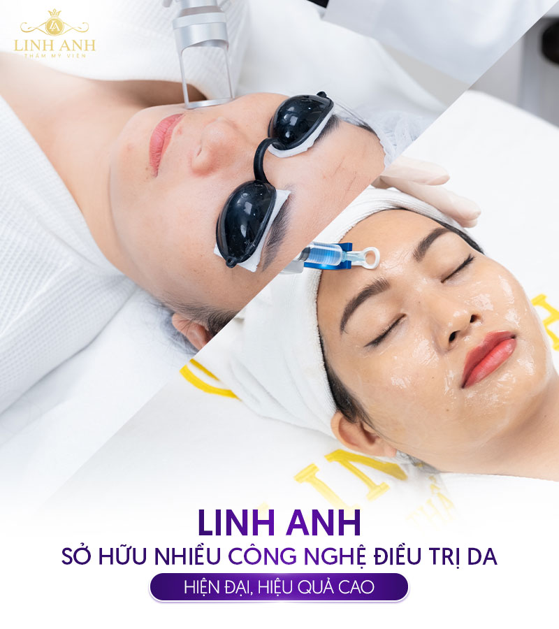 bảng giá điều trị da tại TMV Linh Anh