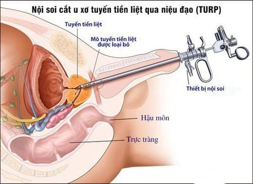 Cắt môi lớn đẹp tự nhiên: Bí quyết tái tạo vùng kín hài hòa và tự tin 2