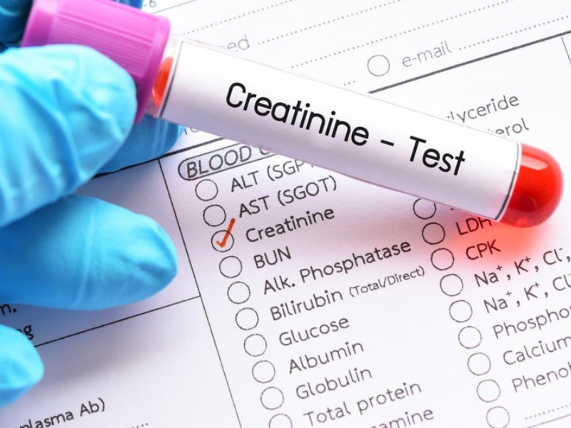 Nên thực hiện các xét nghiệm tầm soát nguy cơ suy thận định kỳ