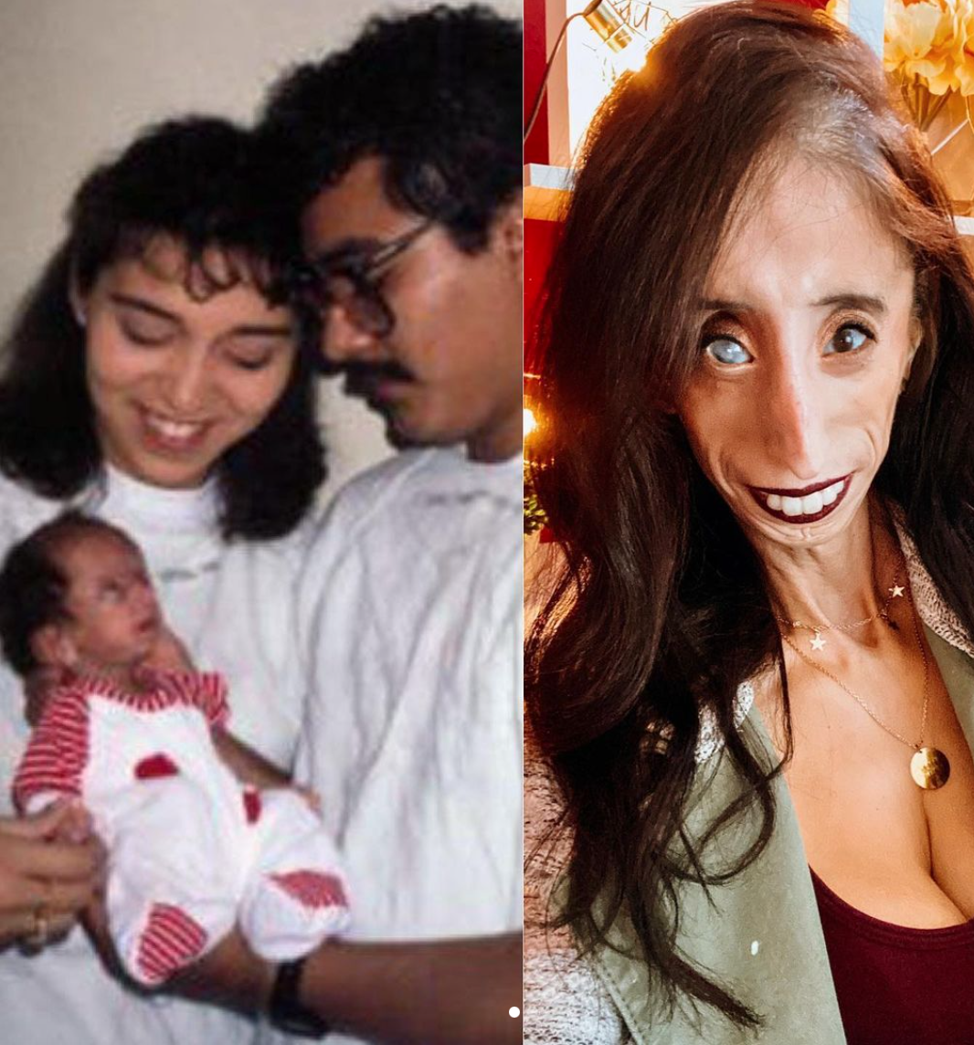 Sinh ra với diện mạo kỳ lạ, cô gái xấu nhất thế giới giờ ra sao? - 1