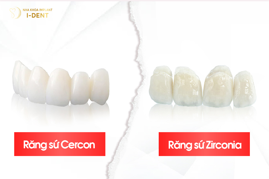 So Sánh Răng Sứ Zirconia Và Cercon – Nên Chọn Loại Nào?