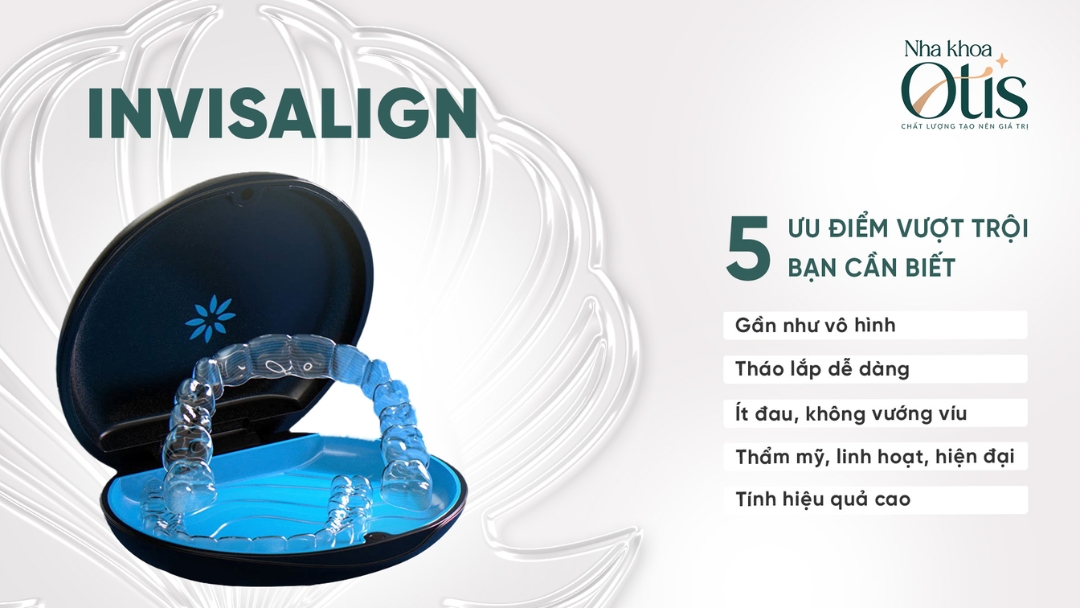 Niềng răng Invisalign với nhiều ưu điểm vượt trội